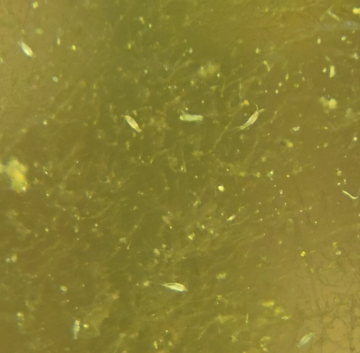 Marine Copepod