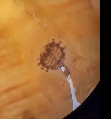Primary species profile image for Shrimp Gill Isopod (Family - Bopyridae) in miniBIOTA.